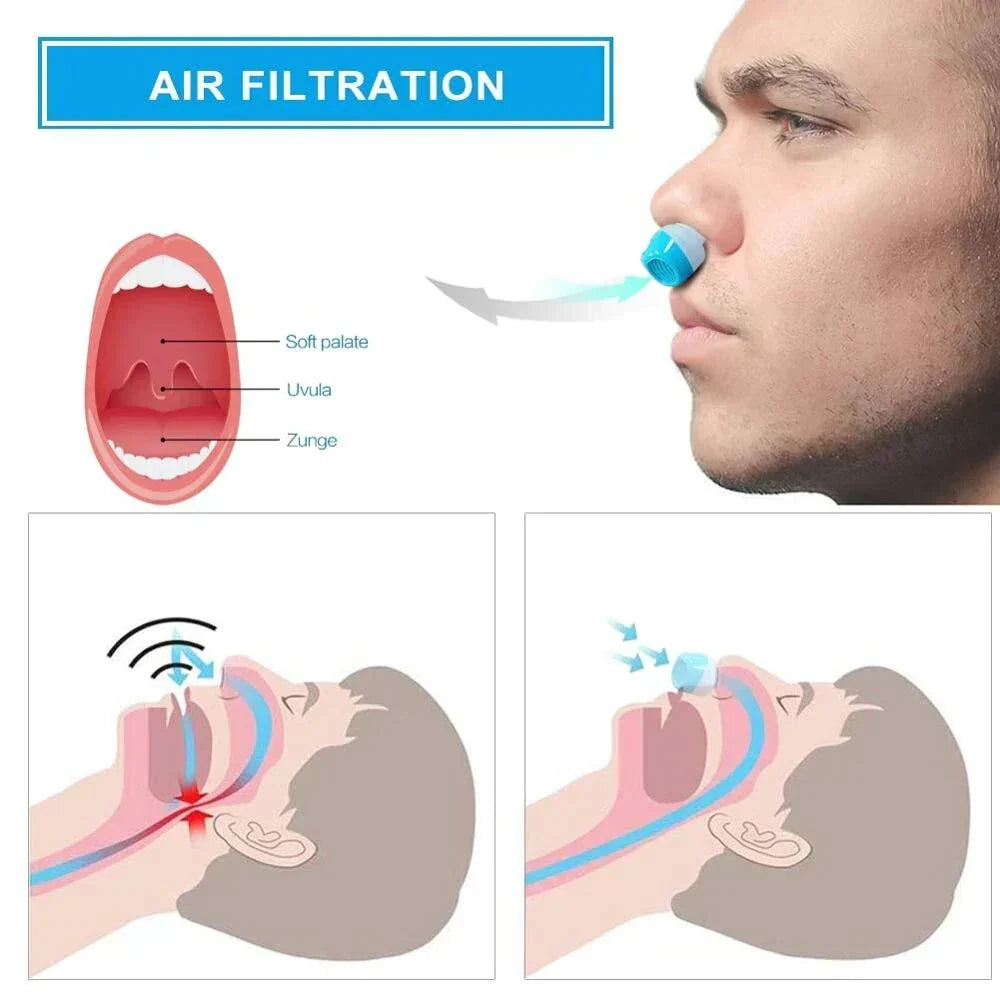 Thermabuild | Airing Micro-CPAP Device for Hassle-Free Anti-Snoring Relief