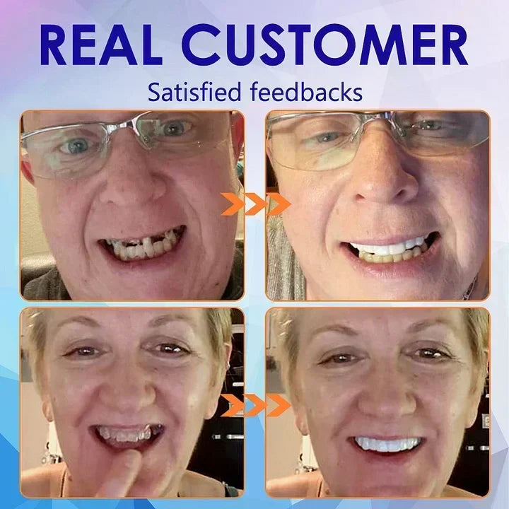 Thermabuild | Flexible Full Denture