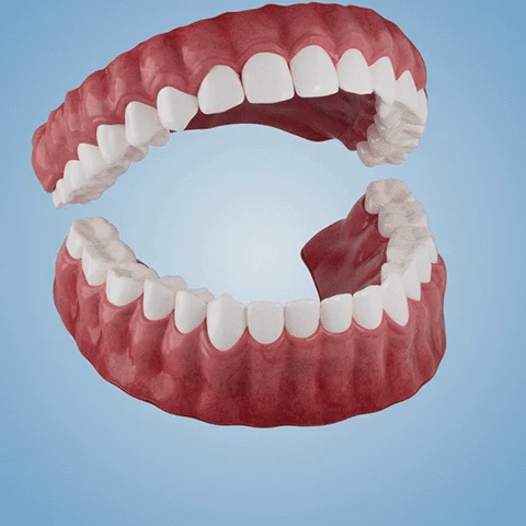 Thermabuild | New Generation Flexible Full Denture Solution