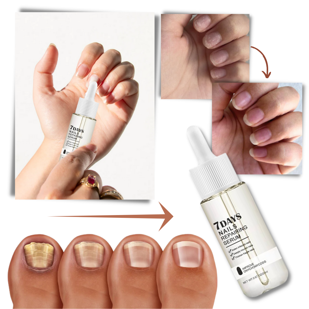 Thermabuild | 7 Days Nail Repair Essence