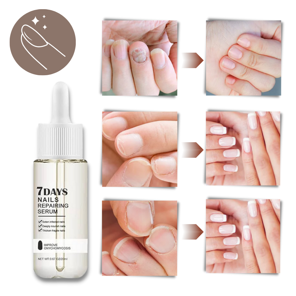 Thermabuild | 7 Days Nail Repair Essence