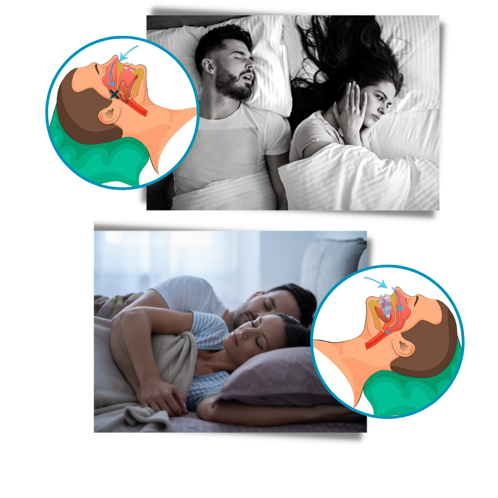 Thermabuild | Advanced anti-snoring device
