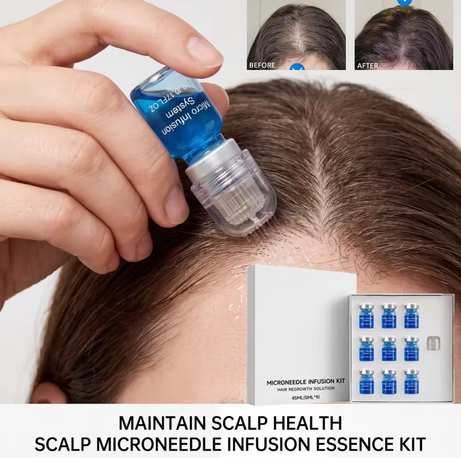 Thermabuild | Microneedle Scalp Care Kit with 9 x 5ml Nourishing Scalp Serum and 0.2mm Needle Head