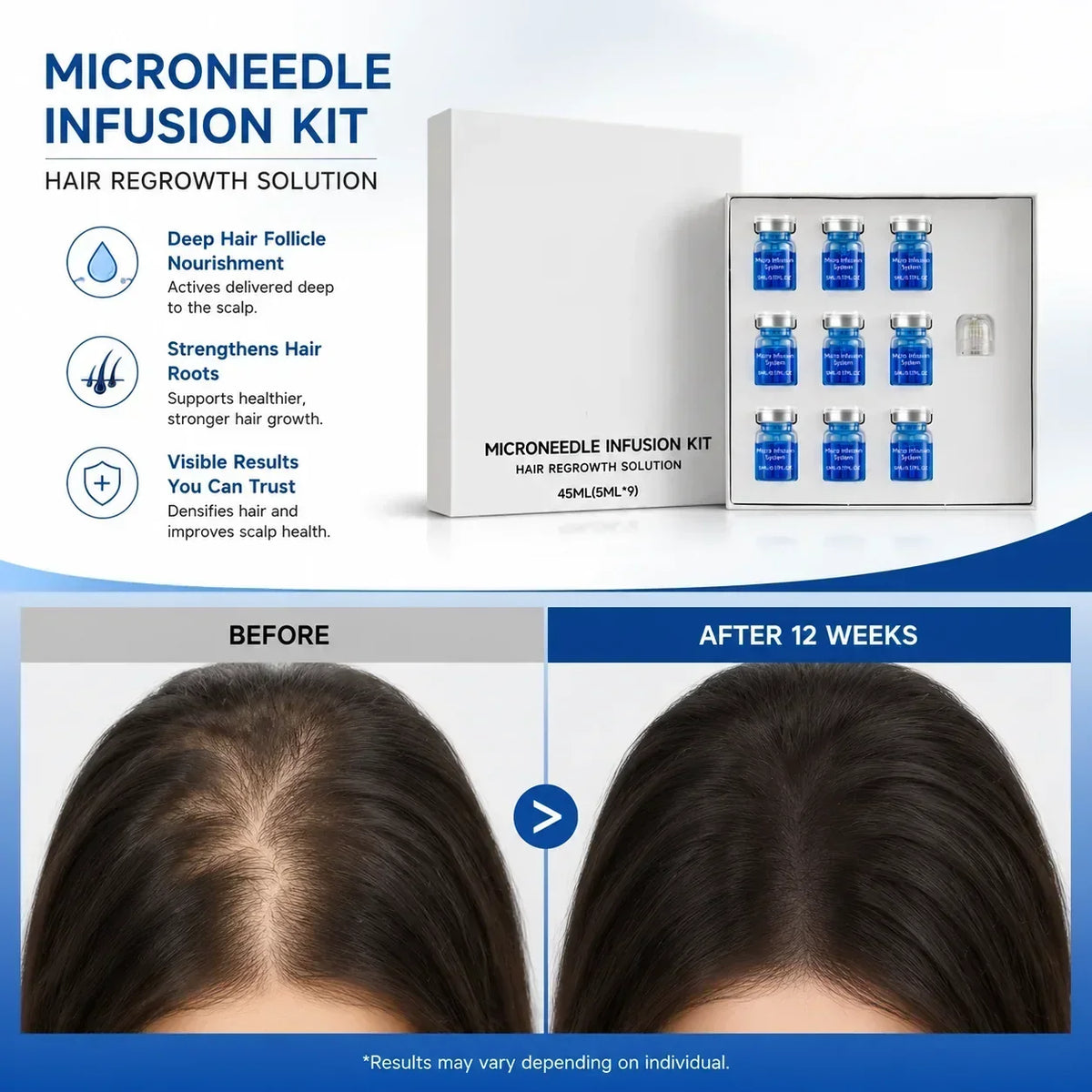 Thermabuild | Microneedle Scalp Care Kit with 9 x 5ml Nourishing Scalp Serum and 0.2mm Needle Head