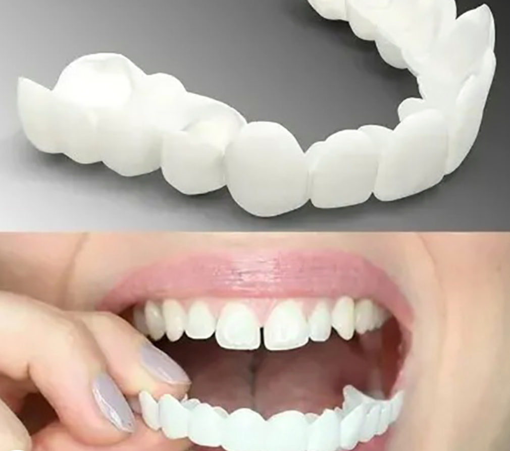 Thermabuild | Adjustable Snap-On Dentures