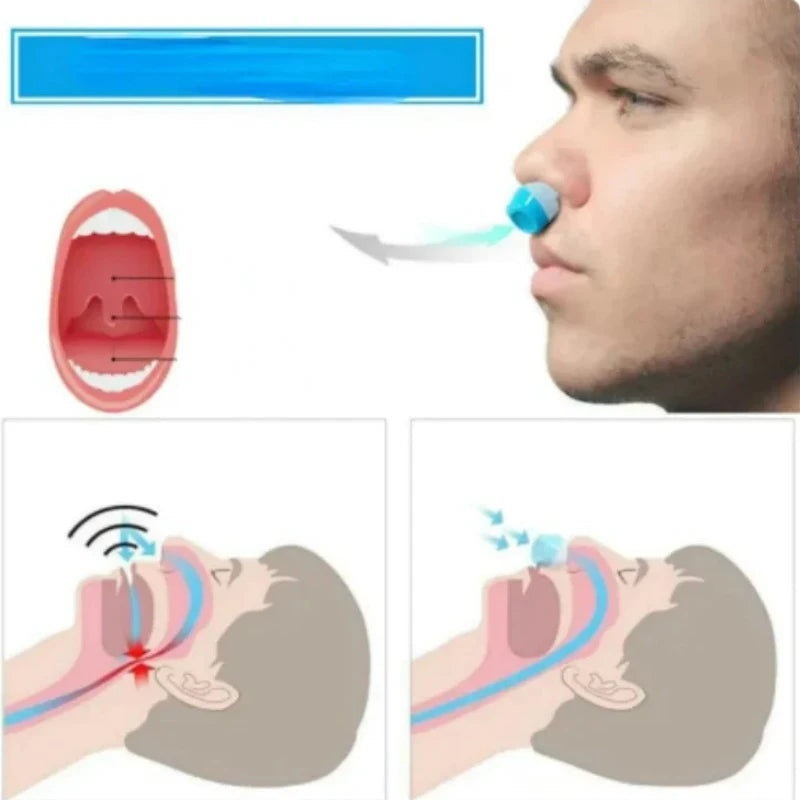 Thermabuild | 2-in-1 Anti Snore Device and Air Purifier Nose Clip