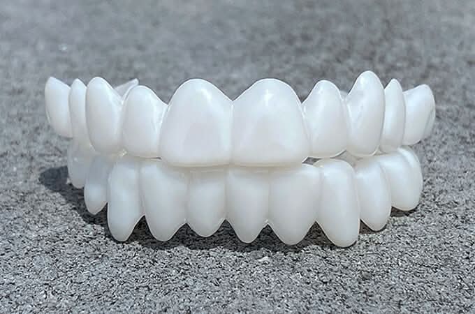 Thermabuild | Natural-Look Dental Veneer for Everyday Confidence